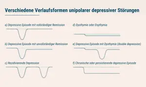 Grafiken zeigen Verläufe von depressiven Episoden, von vollständiger Remission bis zu chronischen Formen, die major depression illustrieren.