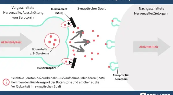 Schema erklärt, wie funktionieren antidepressiva (SSRI): Medikamente blockieren Serotonin-Rücktransport, erhöhen Verfügbarkeit im synaptischen Spalt.