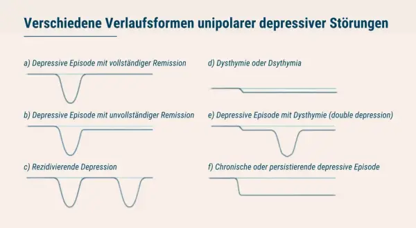 Grafiken zeigen Verläufe von depressiven Episoden, von vollständiger Remission bis zu chronischen Formen, die major depression illustrieren.