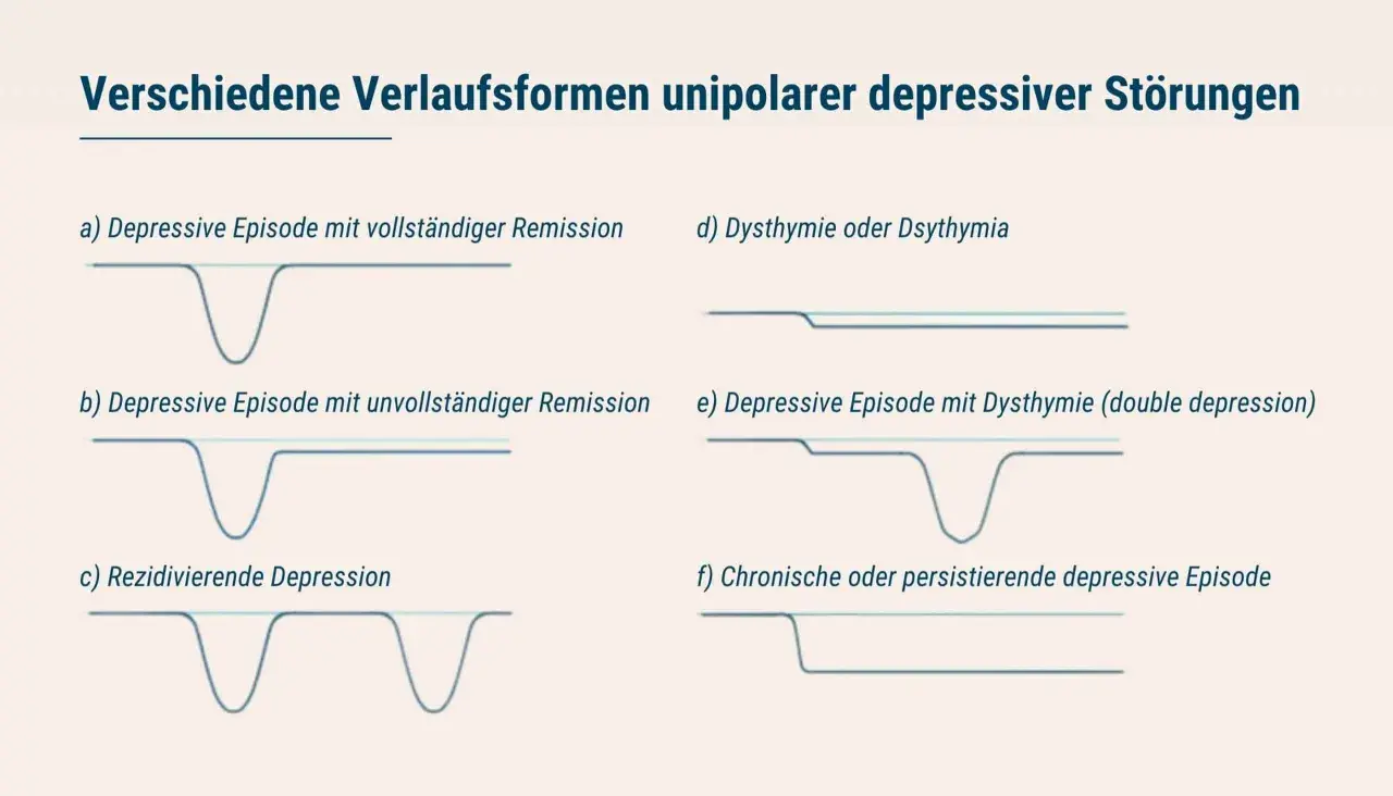 Grafiken zeigen Verläufe von depressiven Episoden, von vollständiger Remission bis zu chronischen Formen, die major depression illustrieren.