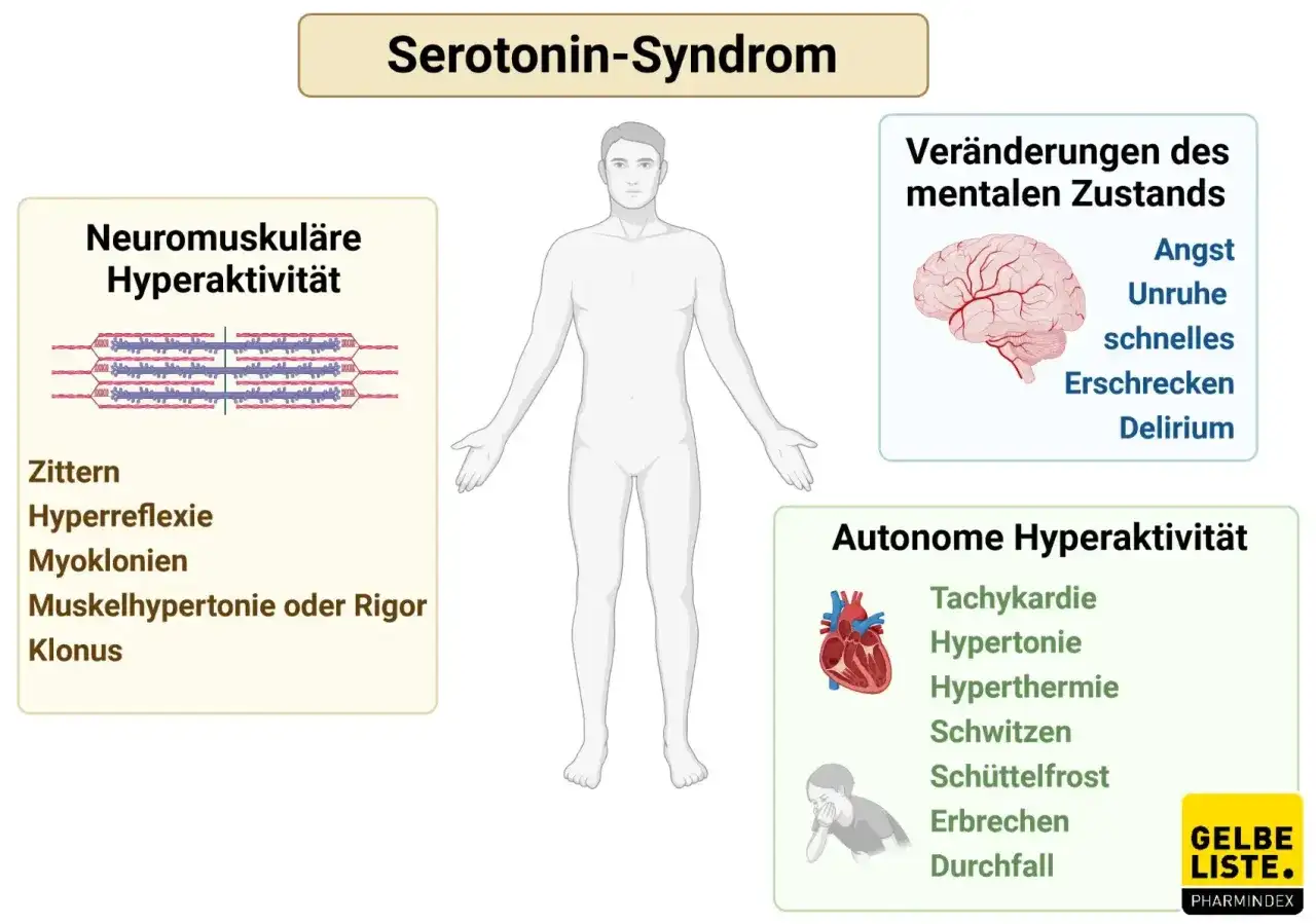 Das Bild zeigt Symptome des Serotonin-Syndroms: neuromuskuläre, autonome und mentale Hyperaktivität.