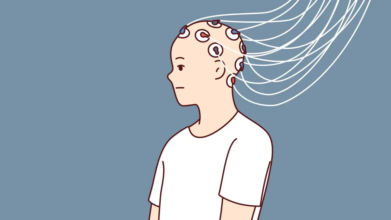 Kopf mit Elektroden, verbunden mit Kabeln, symbolisiert die Behandlung von ekt depression.